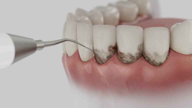 Reliable Emergency Dentist contractor in Lewis County County, MO by Dentist Open Now